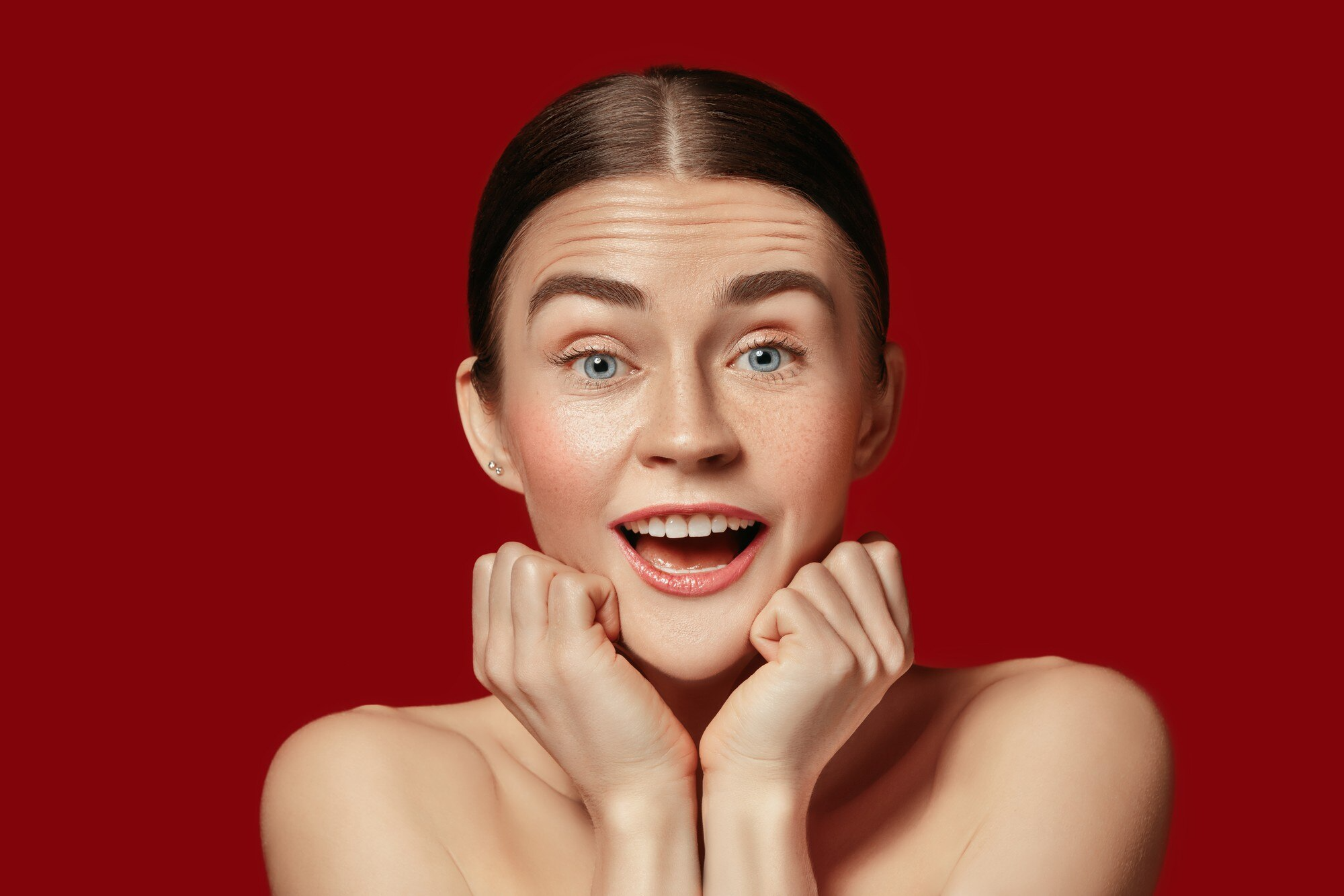 Juvéderm Ultra 4 Volume Restoration