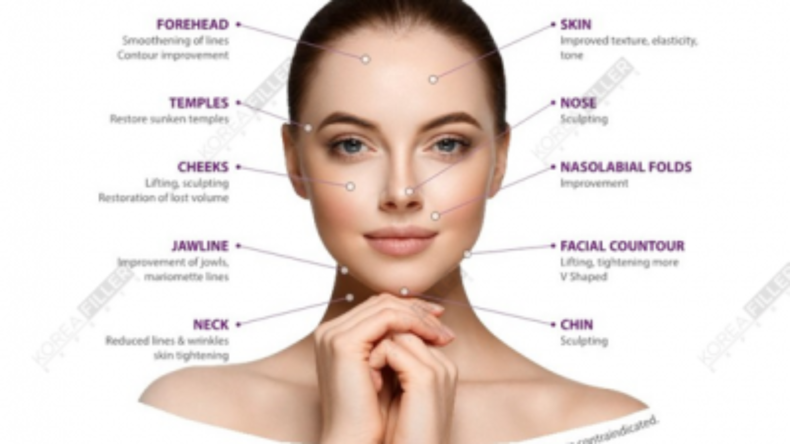 VoLassom Calcium (CaHA) 0.8mL x 2